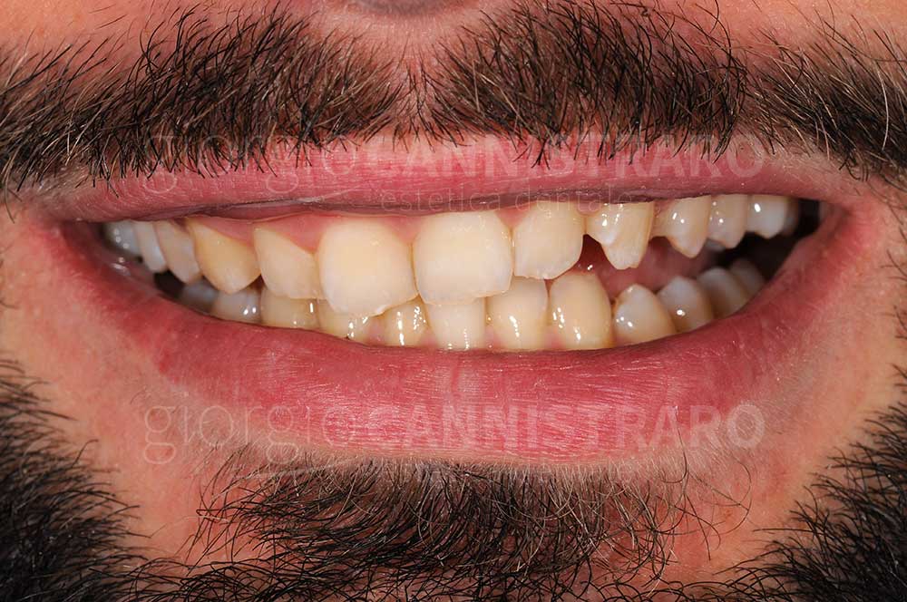 estetica dentale complessa