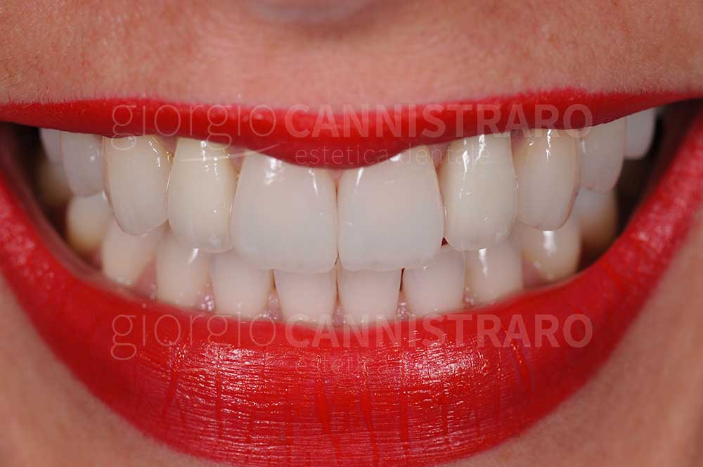 estetica dentale complessa